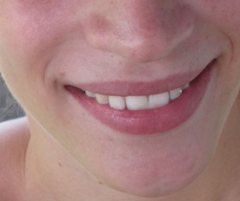 Schöner Mund mit schönen Zähnen